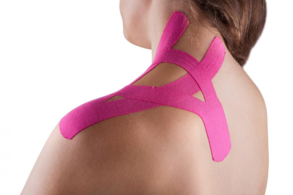 Woman with kinesio taping on her shoulder.